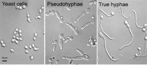 Observing Yeast Under The Microscope » Microscope Club