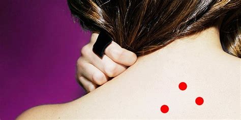 The 7 Most Common Causes Of Itchy Red Bumps | The Huffington Post