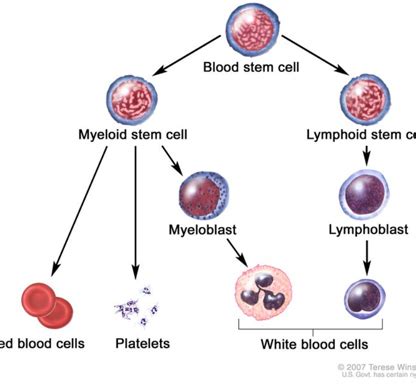 Myeloproliferative Neoplasms