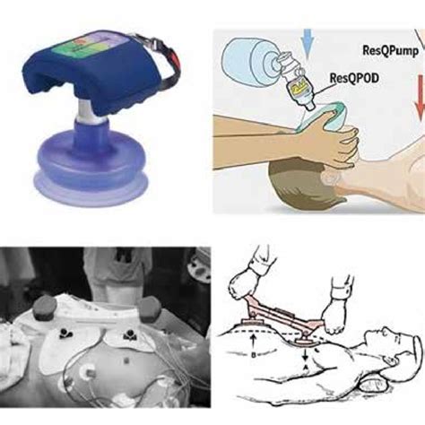 a, b. Other CPR devices. (a) Impedance threshold device (ITD) and... | Download Scientific Diagram