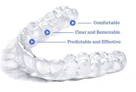 Clear Aligners - Dr Nadya Abedian