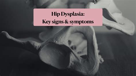 Hip Dysplasia: Key indicators and signs - mybesthealthyblog.com