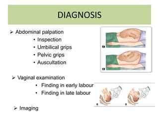 Occipito posterior position | PPT