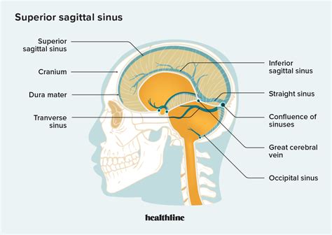 Superior Sagittal Sinus Thrombosis