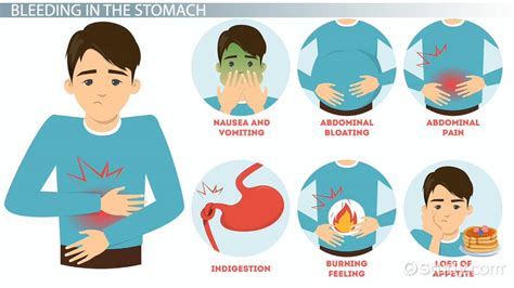 Hematemesis Causes