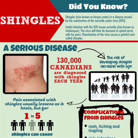 Vaccine for shingles after having shingles | doctorvisit