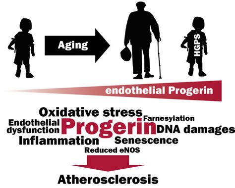 Cells | Free Full-Text | Progerin Expression Induces Inflammation, Oxidative Stress and ...