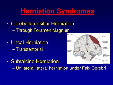 Brain Herniation Syndrome