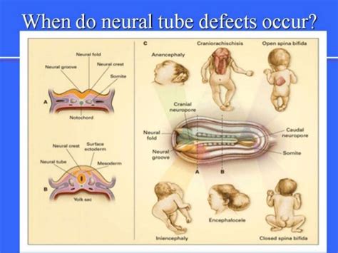 Fetal autopsy