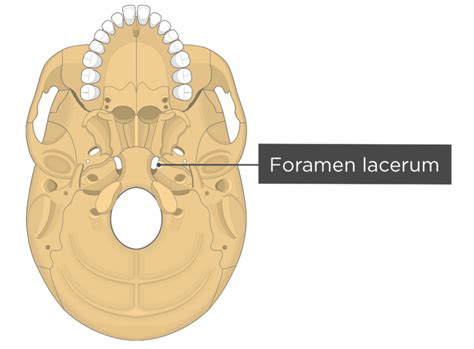 Skull Bone Markings - Inferior View - Part 2