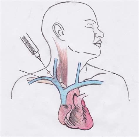 Central Line Anatomy - Anatomical Charts & Posters