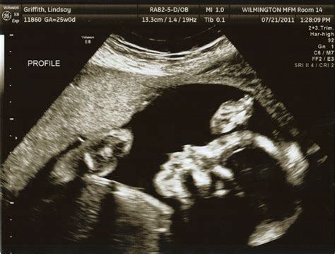 Growing Baby G!: 3D ULTRASOUND!!! Baby G at 25 weeks!