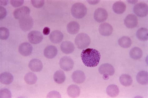 Free picture: thin, film, micrograph, plasmodium vivax, macrogametocyte