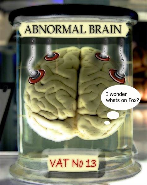 Brain Jack Image: Brain In A Vat