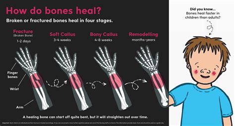 Emma Scheltema Illustration - Bone Healing for Starship Child Health