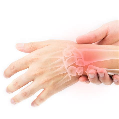 Wrist Fracture | Lancaster Orthopedic Group, Lancaster County, PA ...