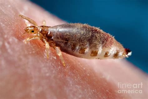 Body Louse Photograph by Science Source