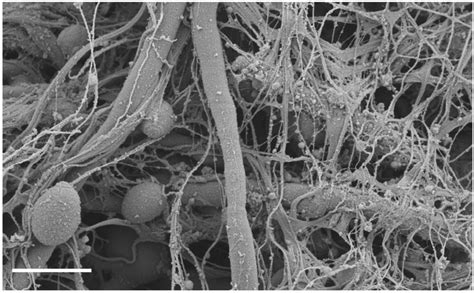 Pathogens | Special Issue : Human Fungal Pathogens