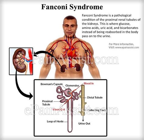 Pin on Abdominal Pain or Stomach Pain