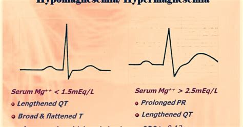 My collections for NEET PG: ECG changes in Electrolyte abnormalities