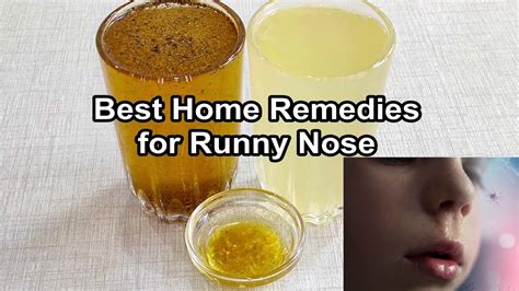 Best Natural Home Remedies to Stop Runny Nose | How to Stop a Runny ...