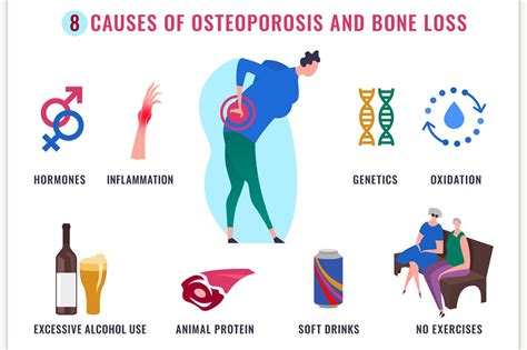 Osteoporosis Infographic Poster | Icons ~ Creative Market