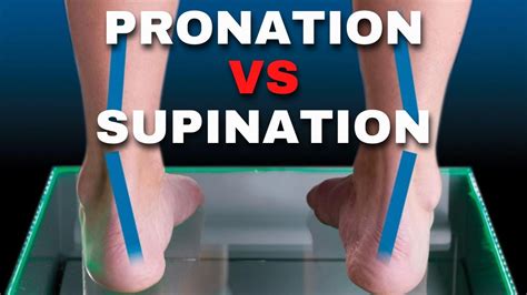 The difference between supination, pronation and over-Pronation - YouTube