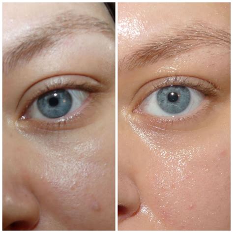 Before and After Retinol Eye Serum - Beauty Insider Community