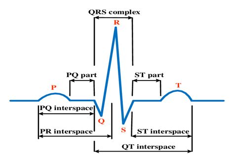 A typical ECG signal and important sections | Download Scientific Diagram