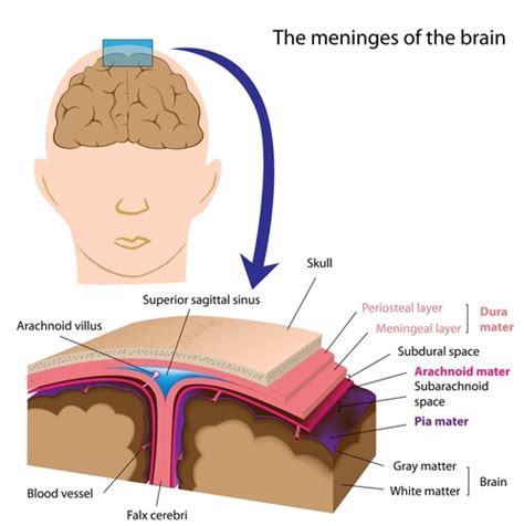 Subdural Haemorraging - Parents Accused