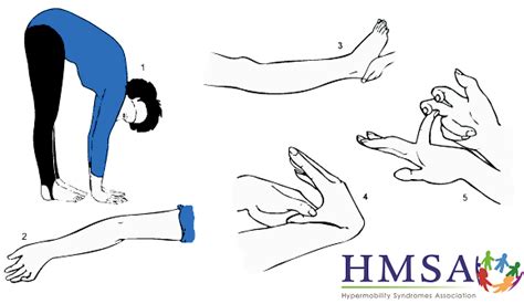 Category: Hypermobility - Simple Wellness Myotherapy, Osteo & Remedial ...