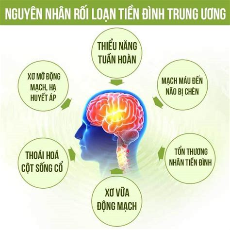 Rối loạn tiền đình trung ương nguy hiểm thế nào?