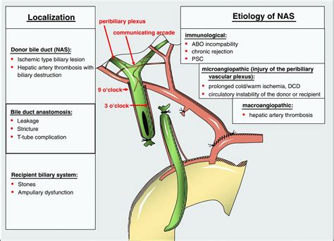 Biliary Complications After Liver Transplantation: Old Problems and New Challenges - Seehofer ...