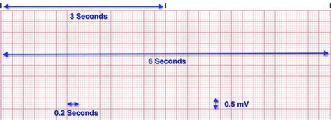 EKG teaching | Ekg, Teaching, Lesson