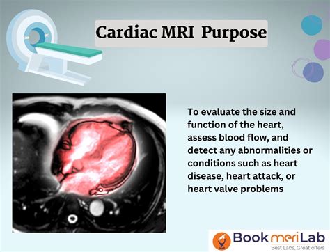 Heart/ Cardiac MRI: Price, Purpose, Preparation & Results [2024]