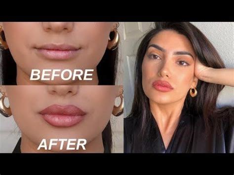 How to get big lips naturally without lip fillers or surgery. Get full lips like Kylie with ...
