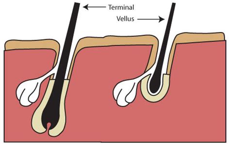 Terminal Hair and Electrolysis - http://topelectrolysisnyc.com/