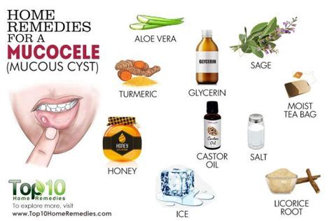 Home Remedies for a Mucocele (Mucous Cyst) | Top 10 Home Remedies