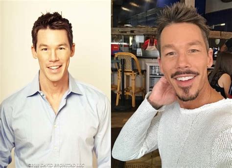 David Bromstad Plastic Surgery Before And After Photos