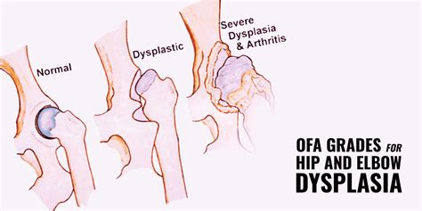 OFA Grades – Classification for Hip & Elbow Dysplasia