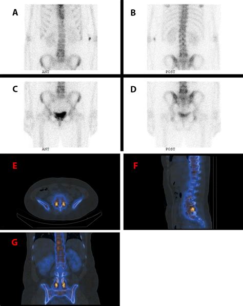 WHAT IS NUCLEAR MEDICINE IMAGING? - Mayfair Diagnostics