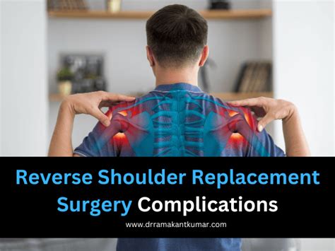 Reverse Shoulder Replacement Surgery {Complications } If Any?