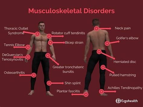 Musculoskeletal Disorders in the Workplace and Prevention.