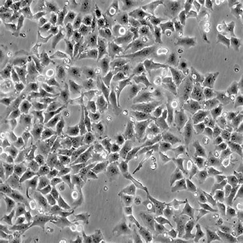 Green Fluorescent HeLa Cell Line – Cells Online