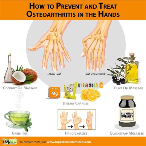 What Is the Best Treatment for Osteoarthritis of the Hands - NathenkruwCochran