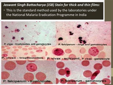 Blood smear staining