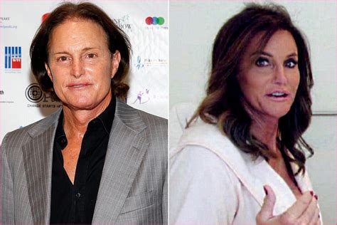 Caitlyn Jenner's new face cost $70,000 | #plasticsurgery #celebrities #celebrity # ...