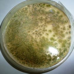 Aspergillus Flavus - Symptoms, Disease, & Treatment | Mold Busters