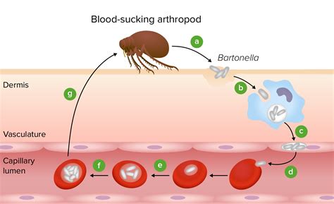 Bartonella Symptoms