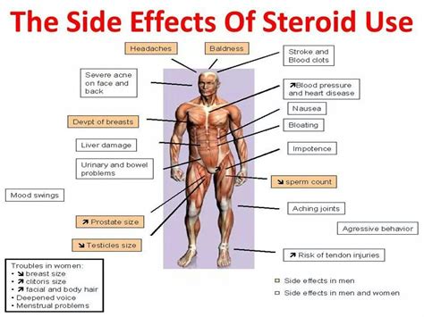 Side effects of Prednisone/Steroid use Raynaud's Disease, Autoimmune Disease, Autoimmune ...